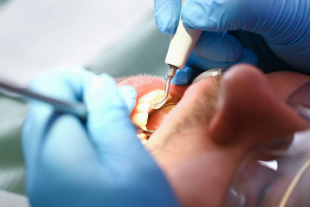 Best Emergency Care for Gum Disease in Maple Glen, PA